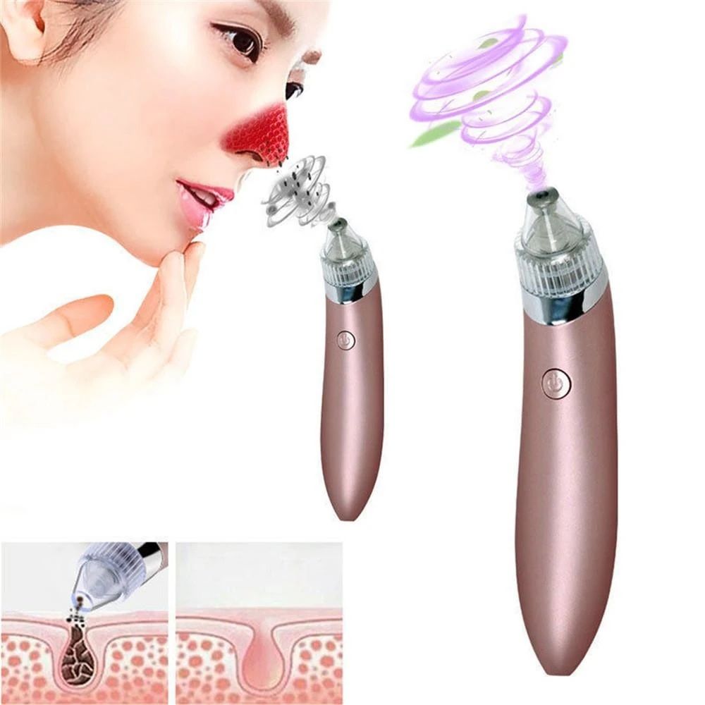 Acne Pimple Pore Cleaner Vacuum Suction Tool - Blackhead Removal